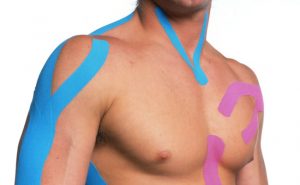 Kinesiotaping vendaje neuromuscular